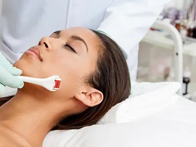 A gloved clinician rolls a microneedling roller along a woman's jawline as she lies with eyes closed