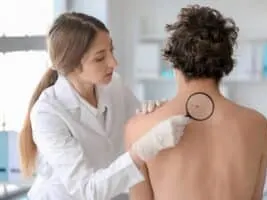 Skin Cancer Treatment Hollywood FL