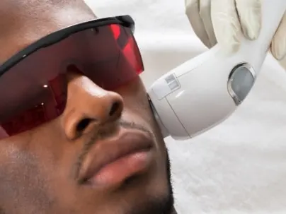 Un modelo con gafas protectoras recibe un tratamiento láser en la mandíbula