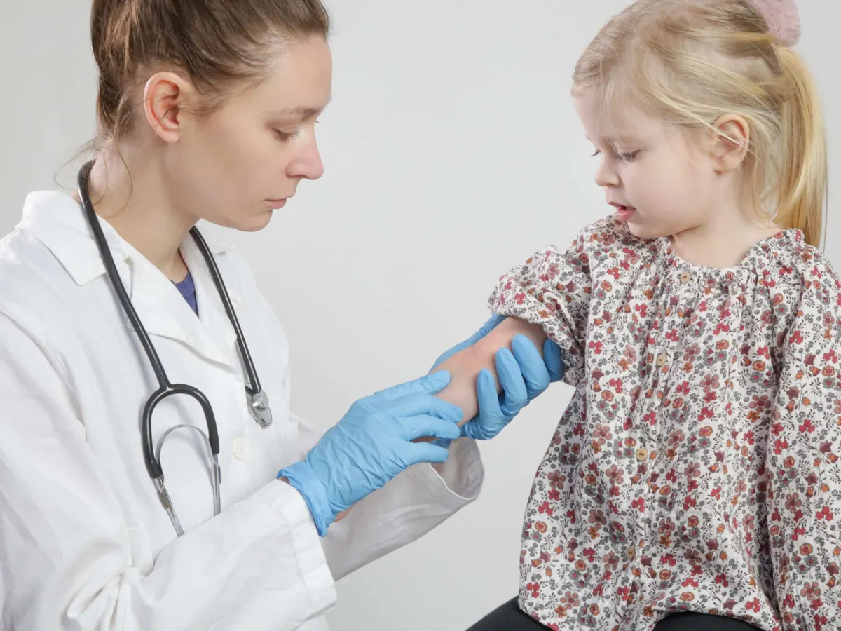 Dermatology looking at eczema flareup on small girl's arm