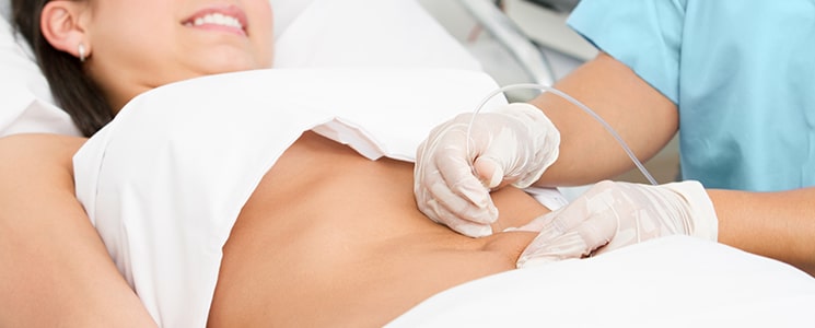 A clinician in gloves treating a smiling woman's abdomen with a thin tube while she lies on a treatment bed
