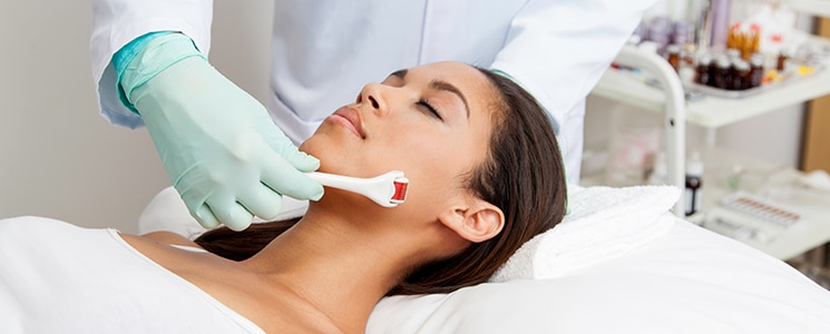 A gloved clinician rolls a microneedling roller along a woman's jawline as she lies with eyes closed