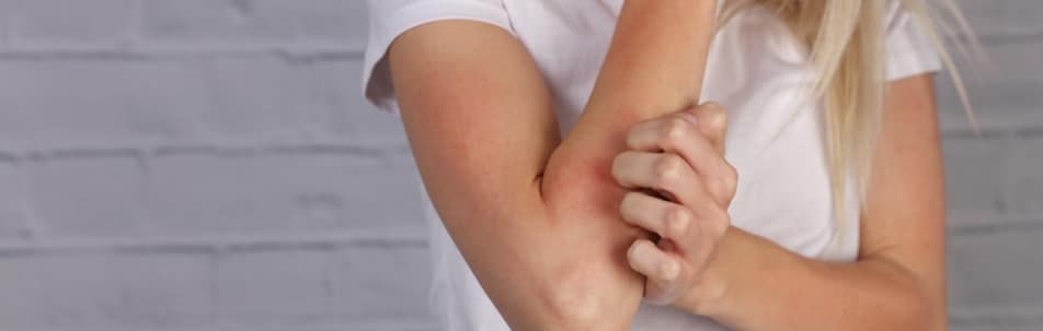 A woman scratching a red, irritated area on the inside of her elbow