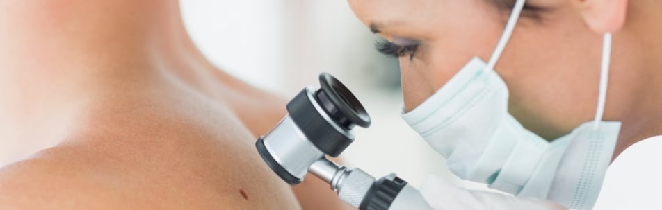 A masked clinician using a dermatoscope to examine a mole on a person's shoulder