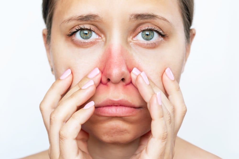 A woman with a red nose and cheeks presses her fingers against her nose, looking at the camera.