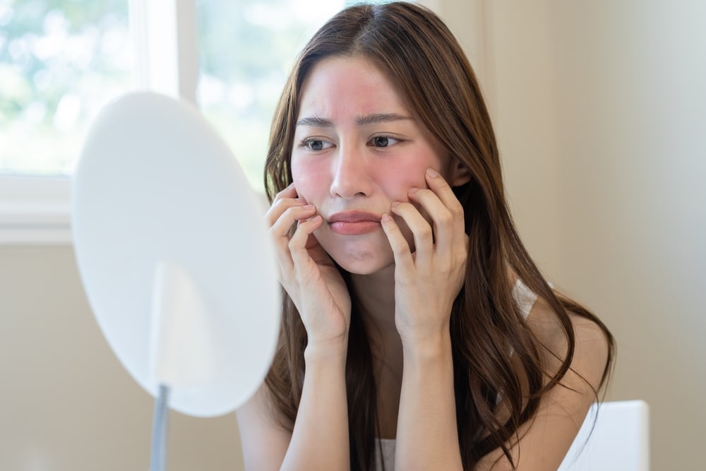 Woman looking in mirror at her red and inflamed face due to spring skin allergies