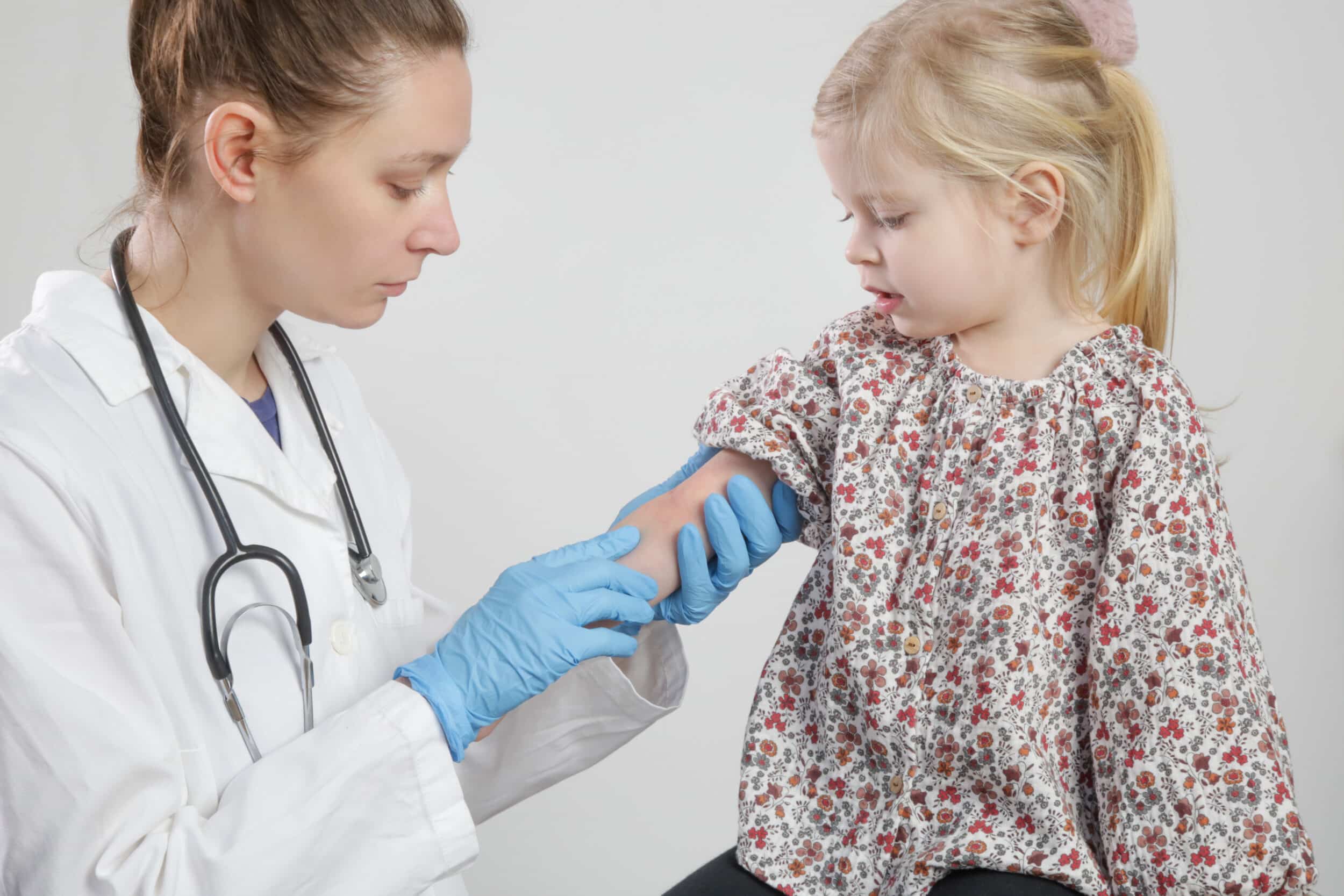 Dermatology looking at eczema flareup on small girl's arm